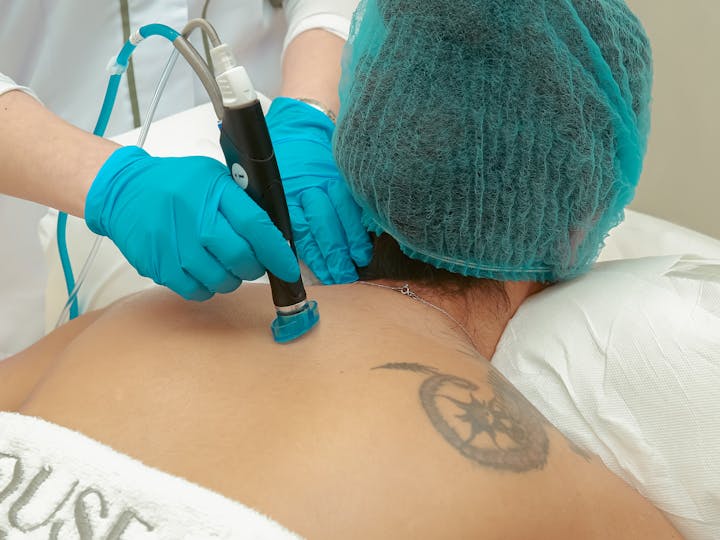 What to Know About Laser Tattoo Removal in Santa Barbara, CA pexels khuramnaseemfilms 12556702